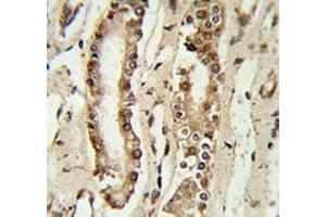 FOXP1 antibody IHC analysis in formalin fixed and paraffin embedded lung tissue. (FOXP1 抗体  (AA 650-677))