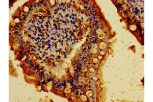 Immunohistochemistry of paraffin-embedded human small intestine tissue using ABIN7146190 at dilution of 1:100 (E-cadherin 抗体  (AA 153-641))