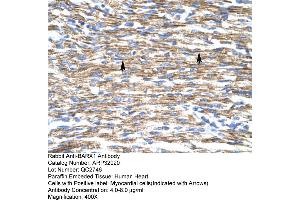 Human Heart (BARX1 抗体  (Middle Region))