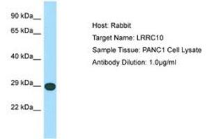 Image no. 1 for anti-Leucine Rich Repeat Containing 10 (LRRC10) (C-Term) antibody (ABIN6750054) (LRRC10 抗体  (C-Term))