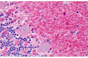 Human Brain, Cerebellum: Formalin-Fixed, Paraffin-Embedded (FFPE) (DLG4 抗体  (C-Term))