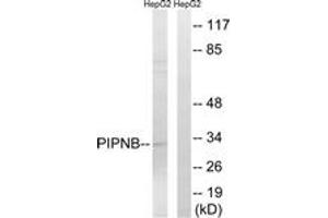Western blot analysis of extracts from HepG2 cells, using PITPNB Antibody. (PITPNB 抗体  (AA 20-69))