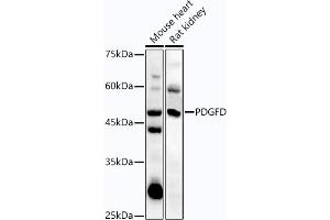 Western blot analysis of extracts of various cell lines, using PDGFD antibody (ABIN7269393) at 1:1000 dilution. (PDGFD 抗体  (AA 185-364))
