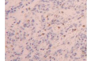 DAB staining on IHC-P; Samples: Human Spleen Tissue (ZYX 抗体  (AA 384-572))