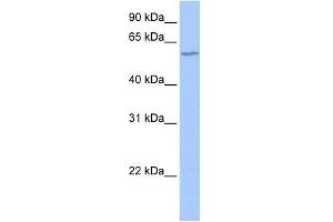 DNTT antibody used at 1 ug/ml to detect target protein. (TdT 抗体  (N-Term))