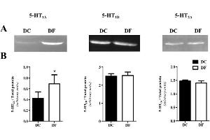 5-HT1A/1D/2A receptor expression in thoracic aortas from control (DC) and fluoxetine-treated (DF) diabetic rats by Western blot. (HTR2A 抗体  (AA 51-150))
