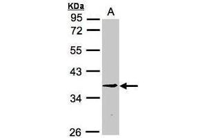 WB Image Sample (30μg whole cell lysate) A:H1299 10% SDS PAGE antibody diluted at 1:3000 (RPF2 抗体)