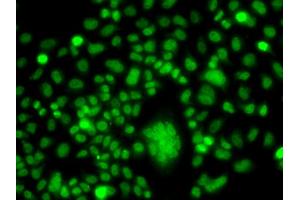Immunofluorescence analysis of A549 cells using PPAN antibody (ABIN5975126). (PPAN 抗体)