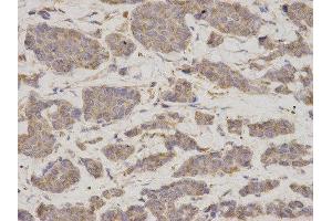 Immunohistochemistry (IHC) image for anti-GDP Dissociation Inhibitor 1 (GDI1) antibody (ABIN1876650) (GDI1 抗体)