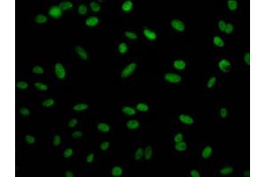 Immunofluorescence staining of Hela Cells with ABIN7127789 at 1:50, counter-stained with DAPI. (Recombinant Retinoblastoma Binding Protein 4 抗体)