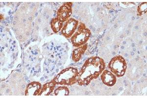 Immunohistochemistry of paraffin-embedded Rat kidney using PDGFR beta Polyclonal Antibody at dilution of 1:100 (40x lens). (PDGFRB 抗体)