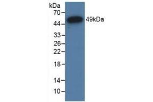 Detection of Recombinant GR, Human using Polyclonal Antibody to Glucocorticoid Receptor (GR) (Glucocorticoid Receptor 抗体  (AA 598-755))