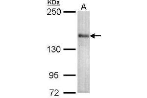 WB Image Sample (30 ug of whole cell lysate) A: 293T 5% SDS PAGE antibody diluted at 1:1000 (CACNA1S 抗体  (Center))
