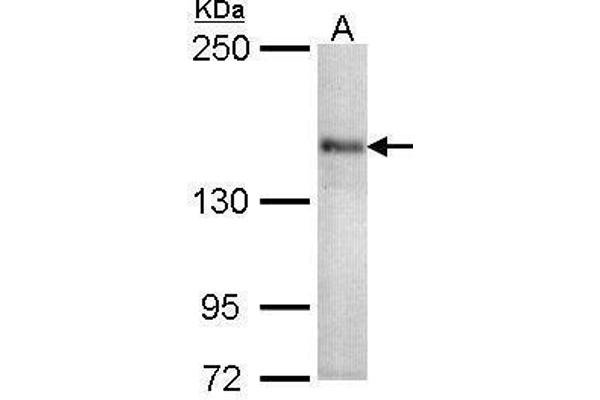 CACNA1S 抗体  (Center)