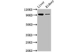 Western Blot Positive WB detected in: Mouse liver tissue, Mouse kidney tissue All lanes: DMGDH antibody at 6. (DMGDH 抗体  (AA 429-524))