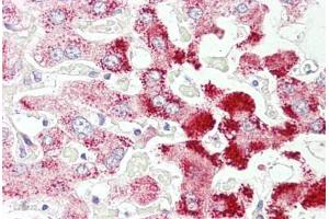 Anti-SCP2 antibody IHC staining of human liver. (SCP2 抗体  (AA 163-175))
