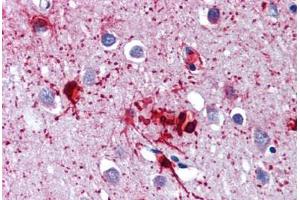 Brain, cortex, Human: Formalin-Fixed, Paraffin-Embedded (FFPE) (DDX58 抗体)