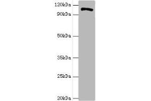 Western blot All lanes: HIP1 antibody at 4 μg/mL + A549 whole cell lysate Secondary Goat polyclonal to rabbit IgG at 1/10000 dilution Predicted band size: 117, 111, 114 kDa Observed band size: 117 kDa (HIP1 抗体  (AA 410-690))
