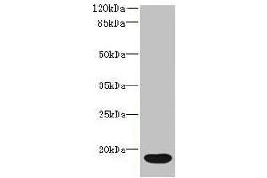 Western blot All lanes: IL36RN antibody at 16 μg/mL + Mouse stomach tissue Secondary Goat polyclonal to rabbit IgG at 1/10000 dilution Predicted band size: 17 kDa Observed band size: 17 kDa (FIL1d 抗体  (AA 1-155))