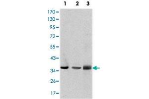 Western blot analysis using LIMS1 monoclonal antobody, clone 5G7  against A-549 (1), Jurkat (2), and HeLa (3) cell lysate.