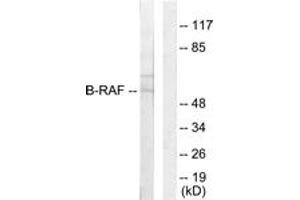 Western blot analysis of extracts from HeLa cells, using B-RAF Antibody. (SNRPE 抗体  (AA 171-220))