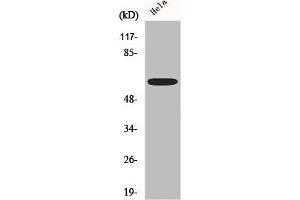 Western Blot analysis of Hela cells using AATF Polyclonal Antibody (AATF 抗体  (N-Term))