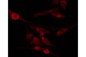 ABIN6274032 staining HepG2 by IF/ICC.