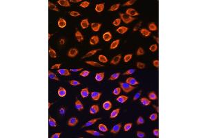 Immunofluorescence analysis of L929 cells using RND1 Rabbit pAb (ABIN6128639, ABIN6146997, ABIN6146998 and ABIN6217798) at dilution of 1:100. (RND1 抗体  (AA 103-232))