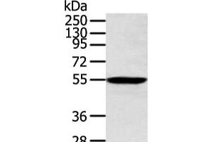 Western blot analysis of Human lung cancer tissue using ALDH2 Polyclonal Antibody at dilution of 1:300 (ALDH2 抗体)