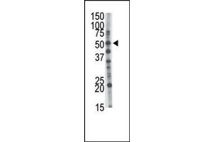 Western Blotting (WB) image for anti-Glucosaminyl (N-Acetyl) Transferase 1, Core 2 (GCNT1) (AA 88-117) antibody (ABIN389033)