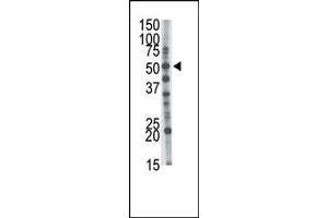 The anti-GCNT1 Pab (ABIN389033 and ABIN2839248) is used in Western blot to detect GCNT1 in mouse kidney tissue lysate. (GCNT1 抗体  (AA 88-117))