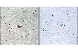 Immunohistochemistry analysis of paraffin-embedded human brain tissue, using PKC delta (Ab-645) Antibody. (PKC delta 抗体  (AA 612-661))