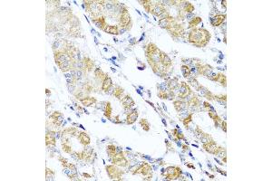 Immunohistochemistry of paraffin-embedded human stomach using D antibody (ABIN6127461, ABIN6139409, ABIN6139410 and ABIN6223779) at dilution of 1:100 (40x lens). (DARS2 抗体  (AA 406-645))
