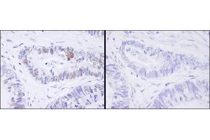 Immunohistochemistry (IHC) image for anti-Minichromosome Maintenance Complex Component 2 (MCM2) (pSer41) antibody (ABIN7448648)