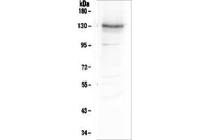 Western blot analysis of Integrin alpha 3 using anti-Integrin alpha 3 antibody (ABIN6719410). (ITGA3 抗体)