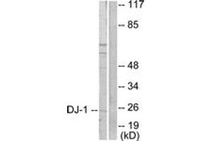 Western blot analysis of extracts from HuvEc cells, using DJ-1 Antibody. (PARK7/DJ1 抗体  (AA 21-70))