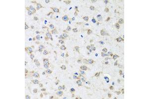 Immunohistochemistry of paraffin-embedded mouse brain using RPLP1 antibody at dilution of 1:100 (x40 lens). (RPLP1 抗体)