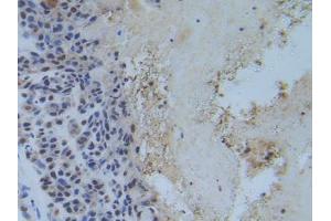 Figure. (RFTN1 抗体  (AA 288-520))