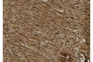 ABIN6277093 at 1/100 staining Rat heart tissue by IHC-P. (PKC epsilon 抗体  (C-Term))
