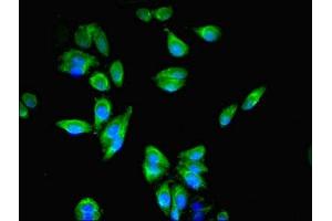 Immunofluorescent analysis of HepG2 cells using ABIN7167064 at dilution of 1:100 and Alexa Fluor 488-congugated AffiniPure Goat Anti-Rabbit IgG(H+L) (RFTN2 抗体  (AA 1-300))