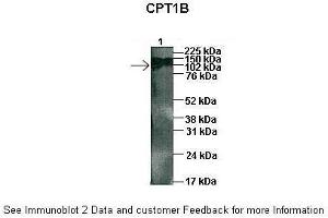 Sample Type :  1: 45ug human capan1 cell lysate  Primary Antibody Dilution :  1:1000  Secondary Antibody :  Anti-rabbit HRP  Secondary Antibody Dilution :  1:5000  Color/Signal Descriptions :  ARP46444-QC16367-WB-image-02  Gene Name :  CPT1B  Submitted by :  Dr. (CPT1B 抗体  (Middle Region))