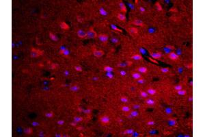 Formalin-fixed and paraffin embedded rat brain labeled with Rabbit Anti-RASAL1 Polyclonal Antibody, Unconjugated (ABIN762251) at 1:200 followed by conjugation to the secondary antibody Goat Anti-Rabbit IgG, Cy3 conjugated used at 1:200 dilution for 40 minutes at 37°C. (RASAL1 抗体  (AA 451-550))