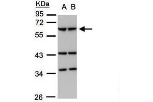 Western Blotting (WB) image for anti-Coronin, Actin Binding Protein, 1A (CORO1A) (C-Term) antibody (ABIN2856372)