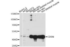 Western blot analysis of extracts of various cell lines, using CDSN antibody. (Corneodesmosin 抗体)