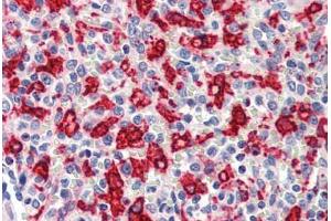 Human Spleen (formalin-fixed, paraffin-embedded) stained with HMOX1 antibody ABIN462109 at 10 ug/ml followed by biotinylated goat anti-rabbit IgG secondary antibody ABIN481713, alkaline phosphatase-streptavidin and chromogen. (HMOX1 抗体)