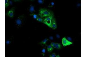 Anti-HP mouse monoclonal antibody (ABIN2453134) immunofluorescent staining of COS7 cells transiently transfected by pCMV6-ENTRY HP (RC223612). (Haptoglobin 抗体)