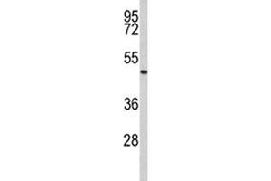 Western blot analysis of Acrosin antibody and human Jurkat lysate. (Acrosin 抗体  (AA 387-416))