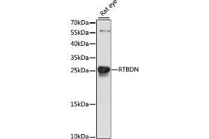 Western blot analysis of extracts of Rat eye using RTBDN Polyclonal Antibody at dilution of 1:1000. (Retbindin 抗体)