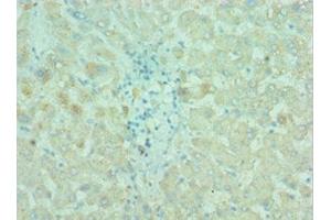Immunohistochemistry of paraffin-embedded human liver tissue using ABIN7145198 at dilution of 1:100 (BIRC2 抗体  (AA 1-300))