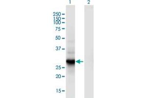 Western Blot analysis of RGS18 expression in transfected 293T cell line by RGS18 monoclonal antibody (M02), clone 1G12. (RGS18 抗体  (AA 1-235))